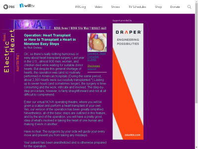 Thumbnail for Operation: Heart Transplant or How to Transplant a Heart in Nineteen Easy Steps resource